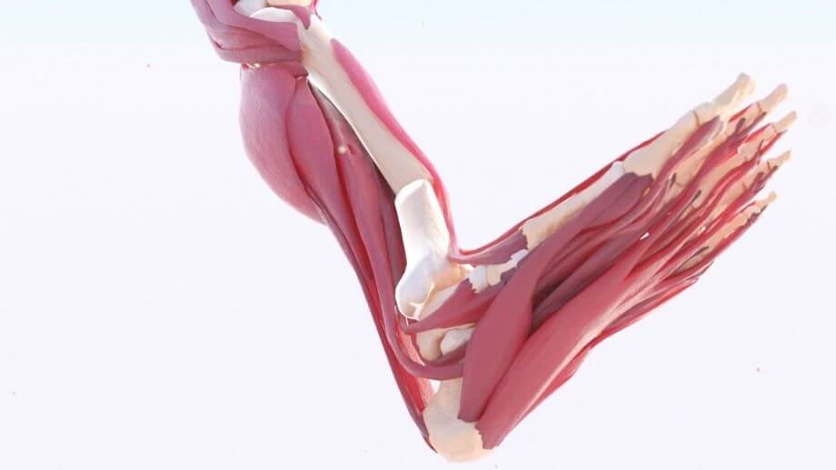 Tibial Fracture